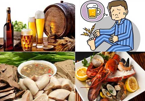 BỆNH GOUT VÀ MỐI NGUY CƠ TIỀM ẨN - Dược Phẩm Hadaco